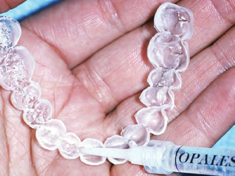 Домашнее отбеливание зубов OPALESCENCE