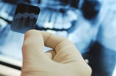 Профилактика и гигиена полости рта