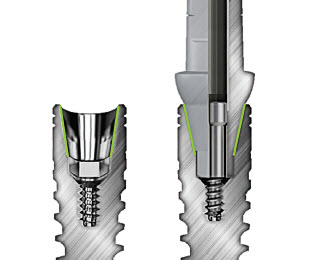 Зубные импланты Bio3 Implants
